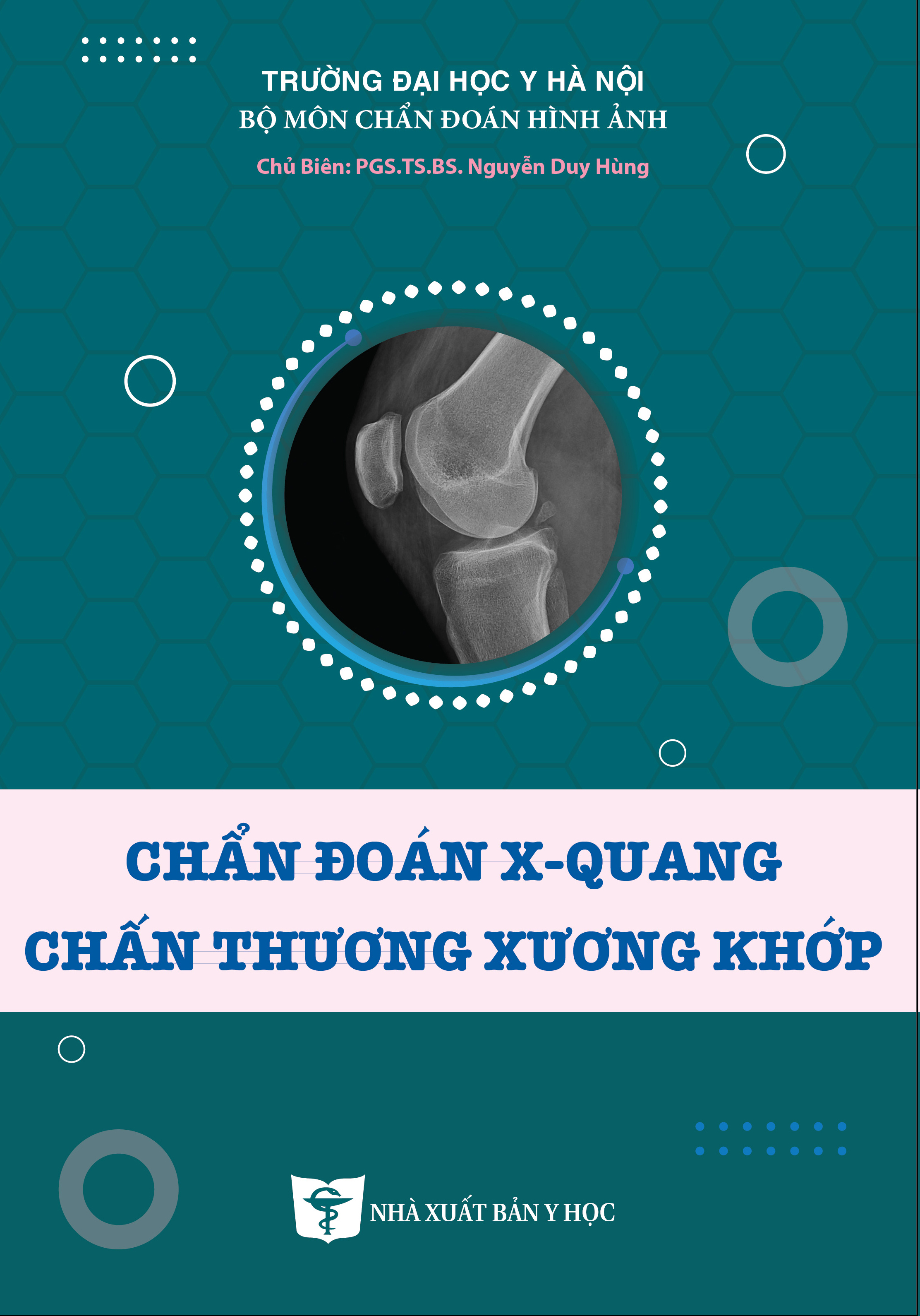 Chẩn đoán X-quang chấn thương xương khớp