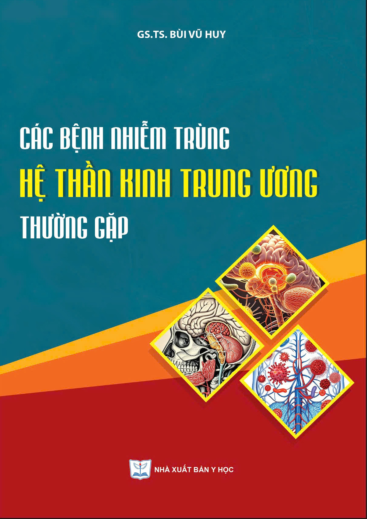 Các bệnh nhiễm trùng hệ thần kinh trung ương thường gặp