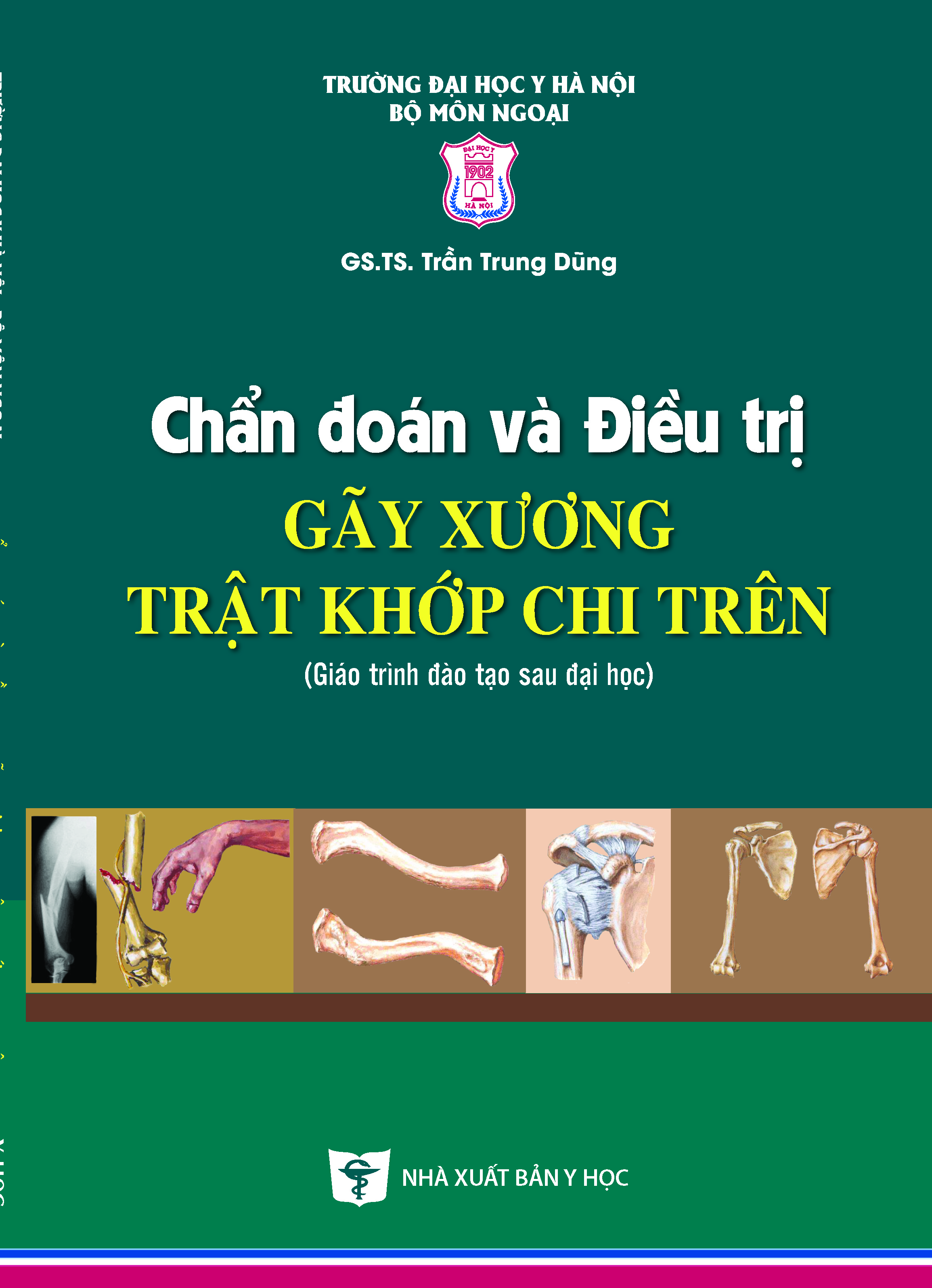 Chẩn đoán và điều trị gãy xương trật khớp chi trên (Giáo trình đào tạo sau đại học)