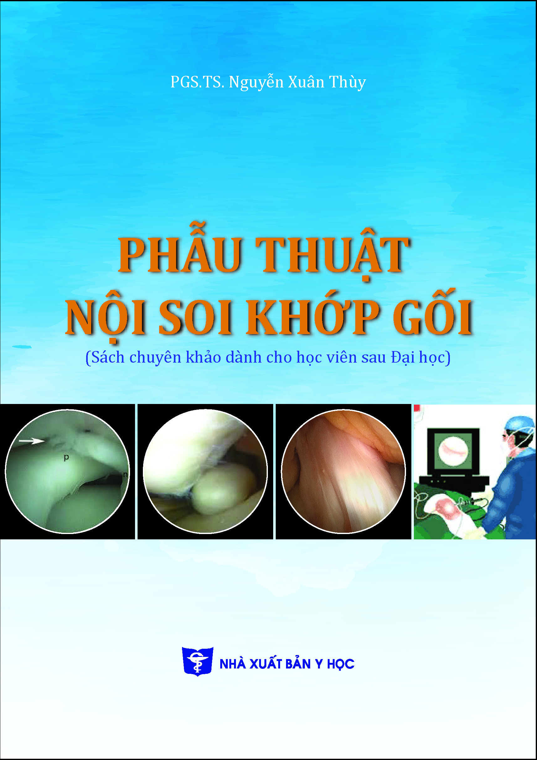 Phẫu thuật nội soi khớp gối (Sách chuyên khảo dành cho học viên sau đại học)