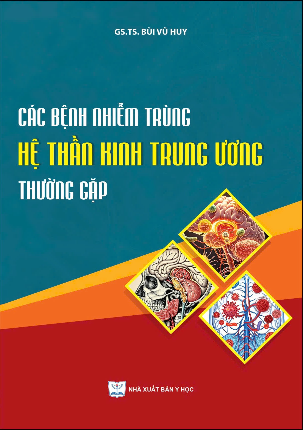 Các bệnh nhiễm trùng hệ thần kinh trung ương thường gặp
