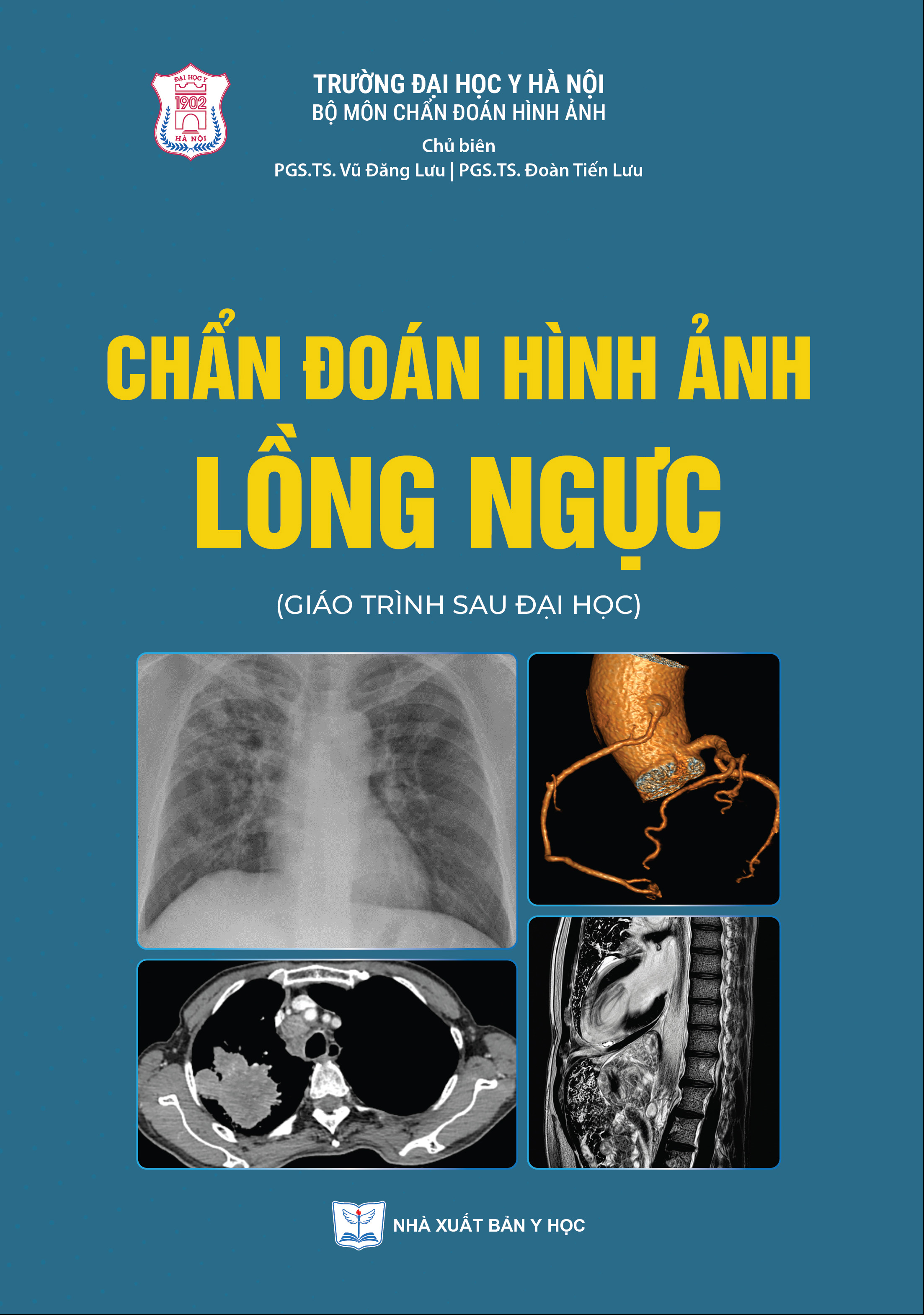 Chẩn đoán hình ảnh lồng ngực (Giáo trình sau đại học)