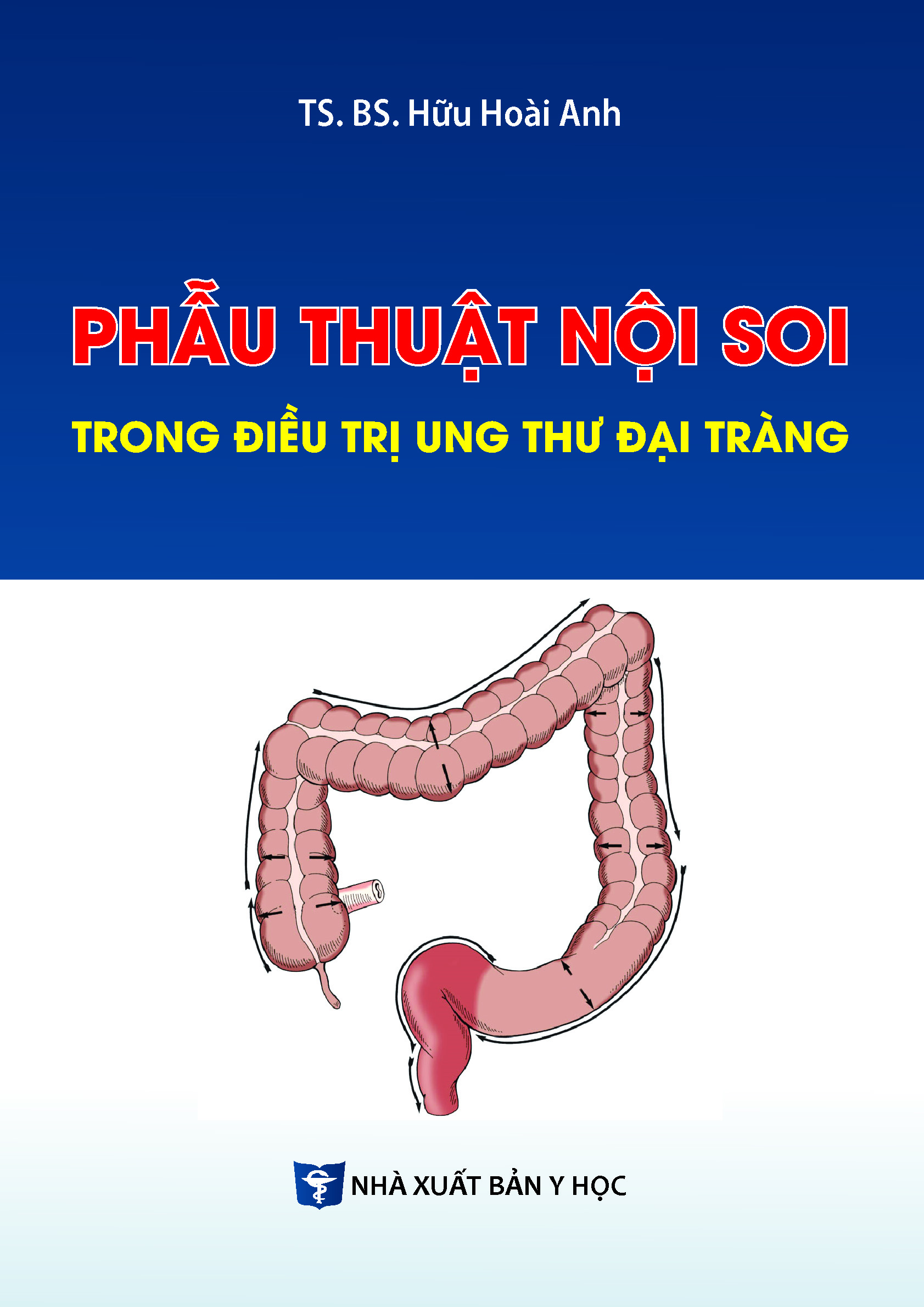 Phẫu thuật nội soi trong điều trị ung thư đại tràng