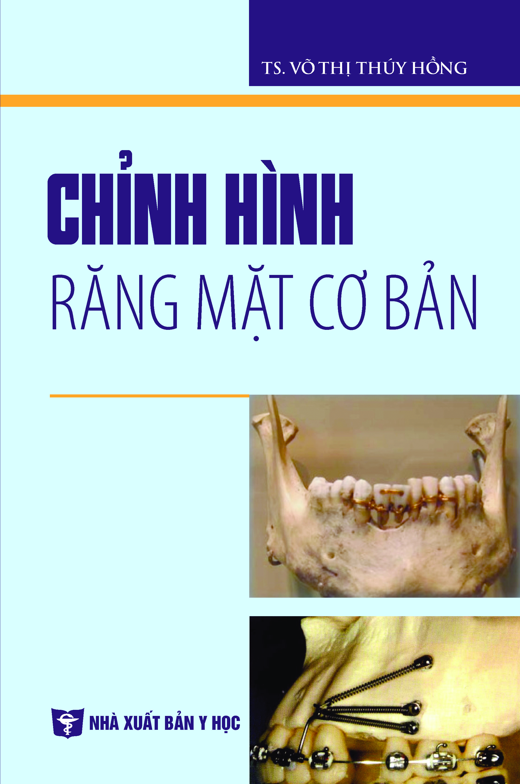 Chỉnh hình răng mặt cơ bản