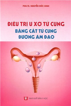 Điều trị u xơ tử cung bằng cắt tử cung đường âm đạo