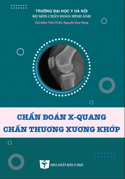 Chẩn đoán X-quang chấn thương xương khớp