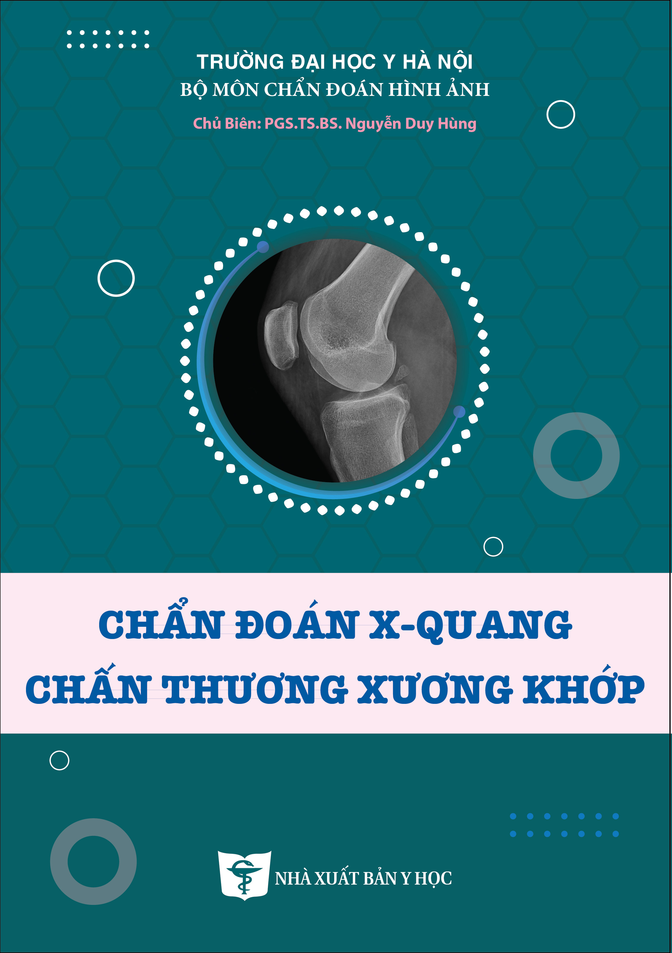 Chẩn đoán X-quang chấn thương xương khớp