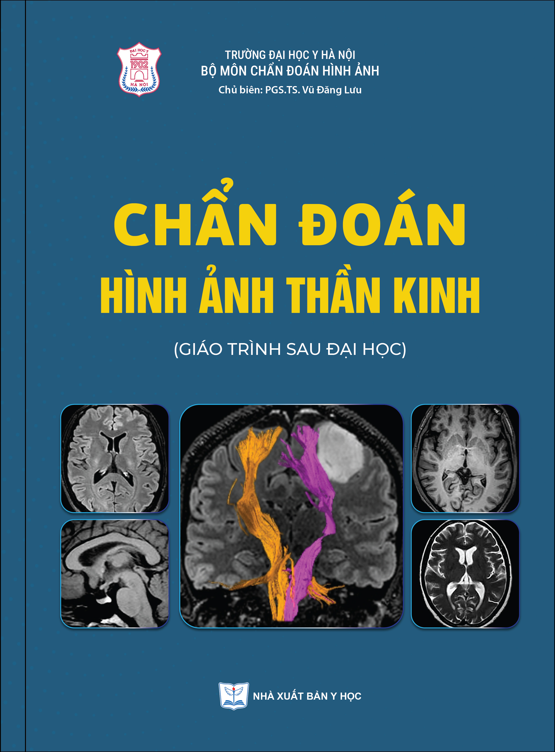 Chẩn đoán hình ảnh thần kinh (Giáo trình sau đại học)