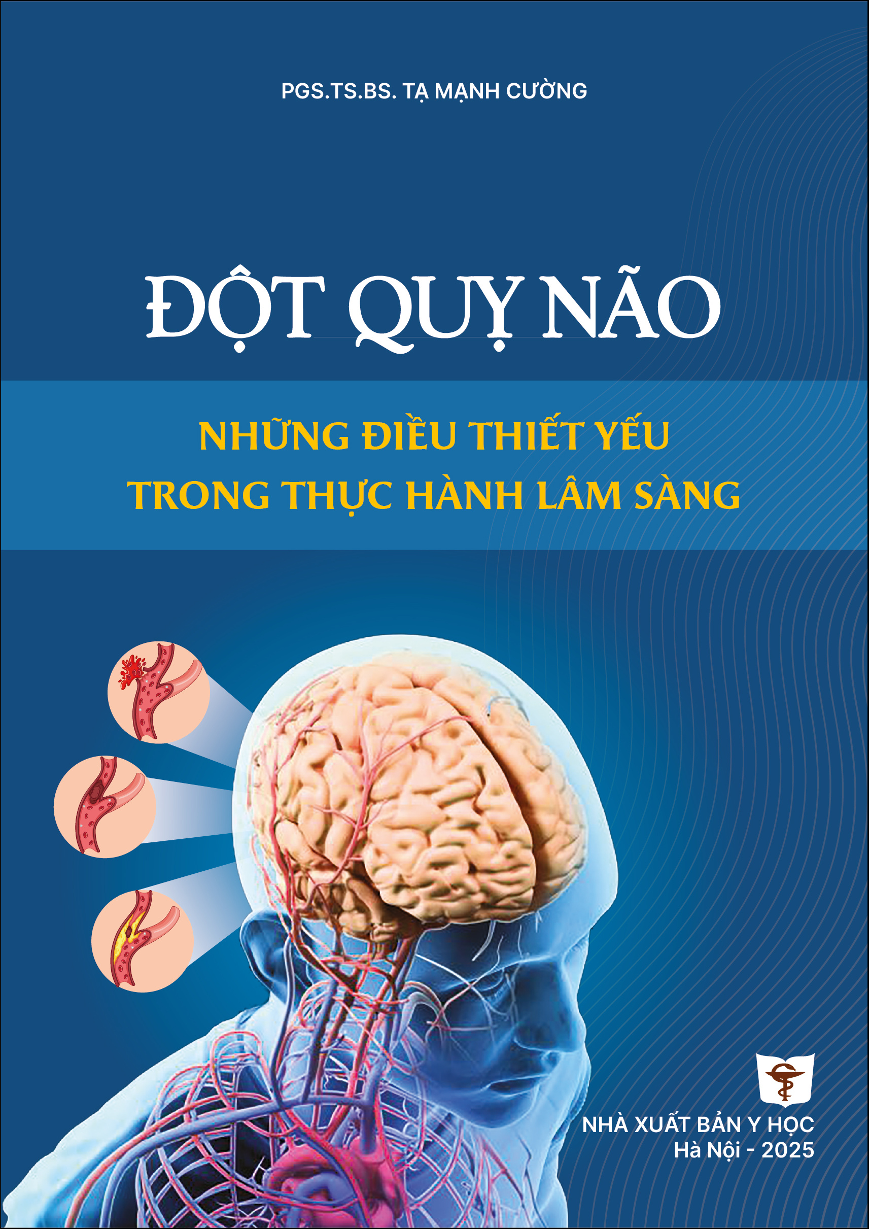 Đột quỵ não những điều thiết yếu trong thực hành lâm sàng