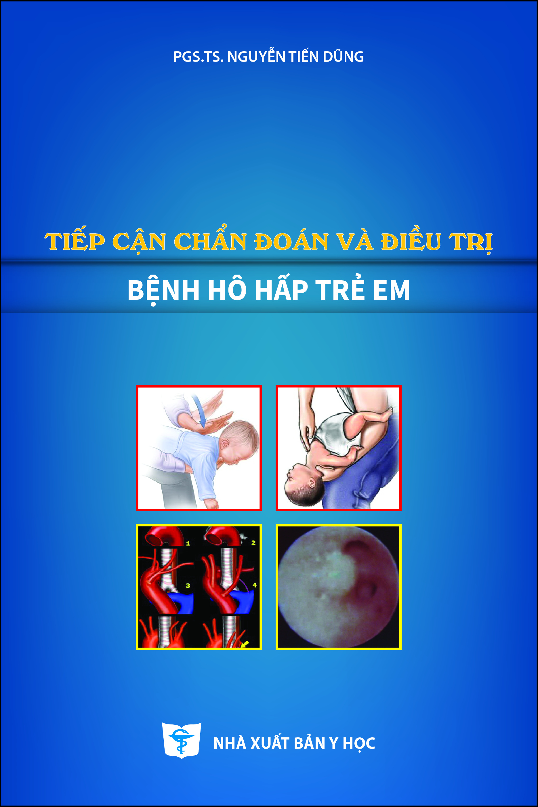 Tiếp cận chẩn đoán và điều trị bệnh hô hấp trẻ em