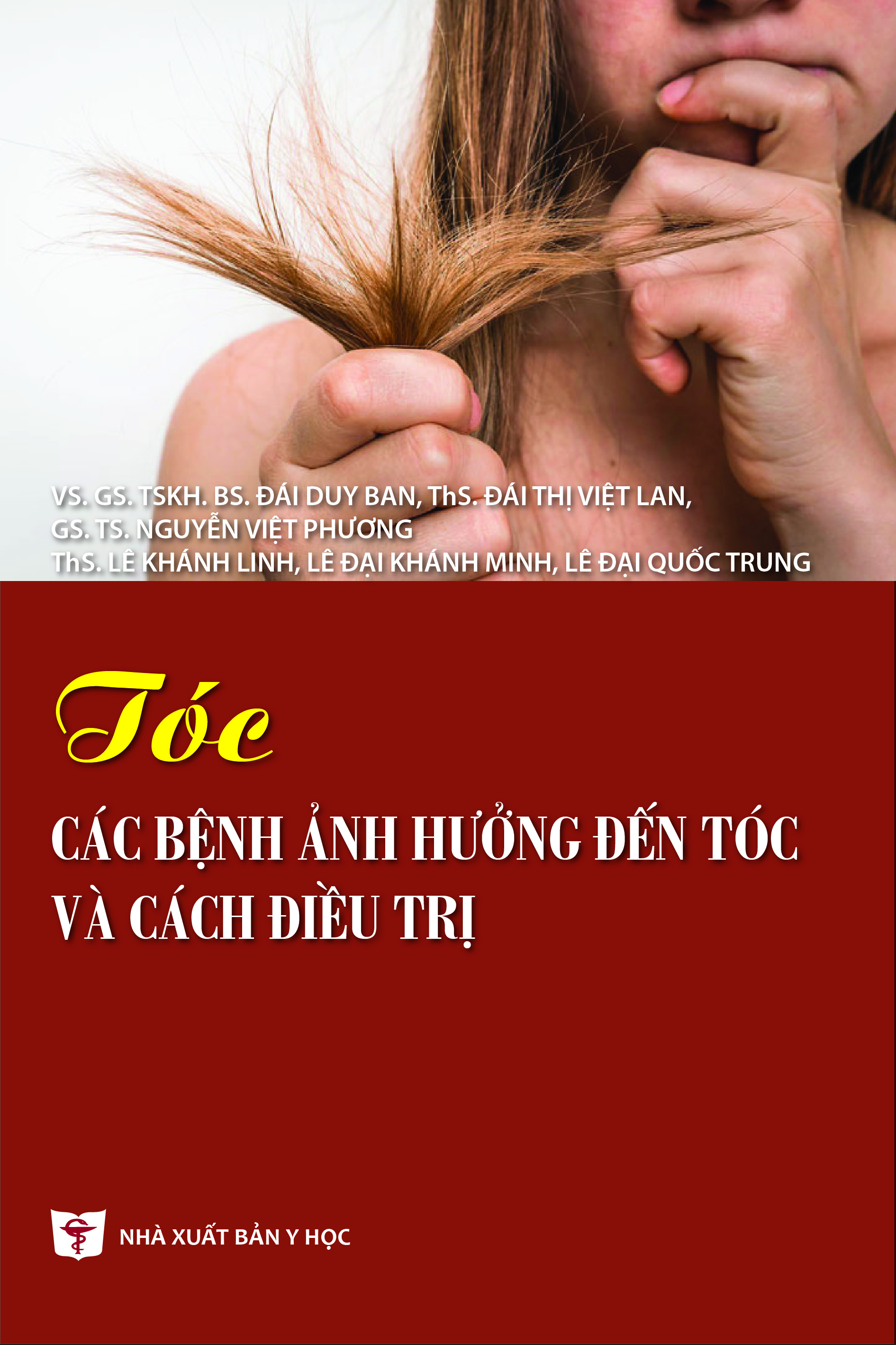 Tóc các bệnh ảnh hưởng đến tóc và cách điều trị