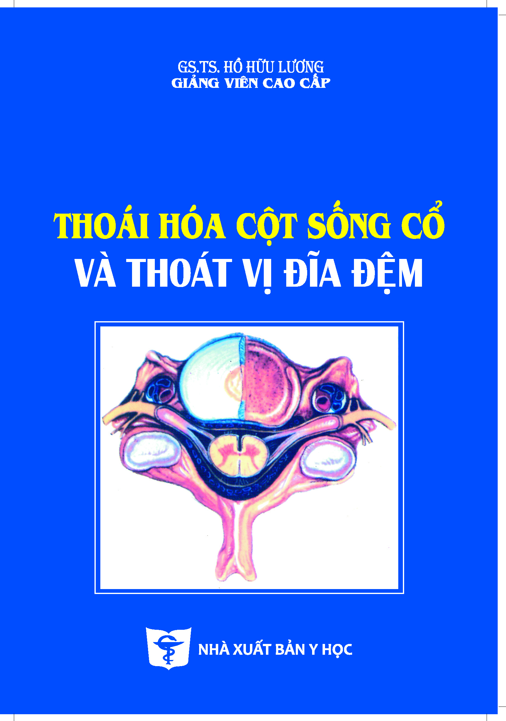 Thoái hóa cột sống cổ và thoát vị đĩa đệm