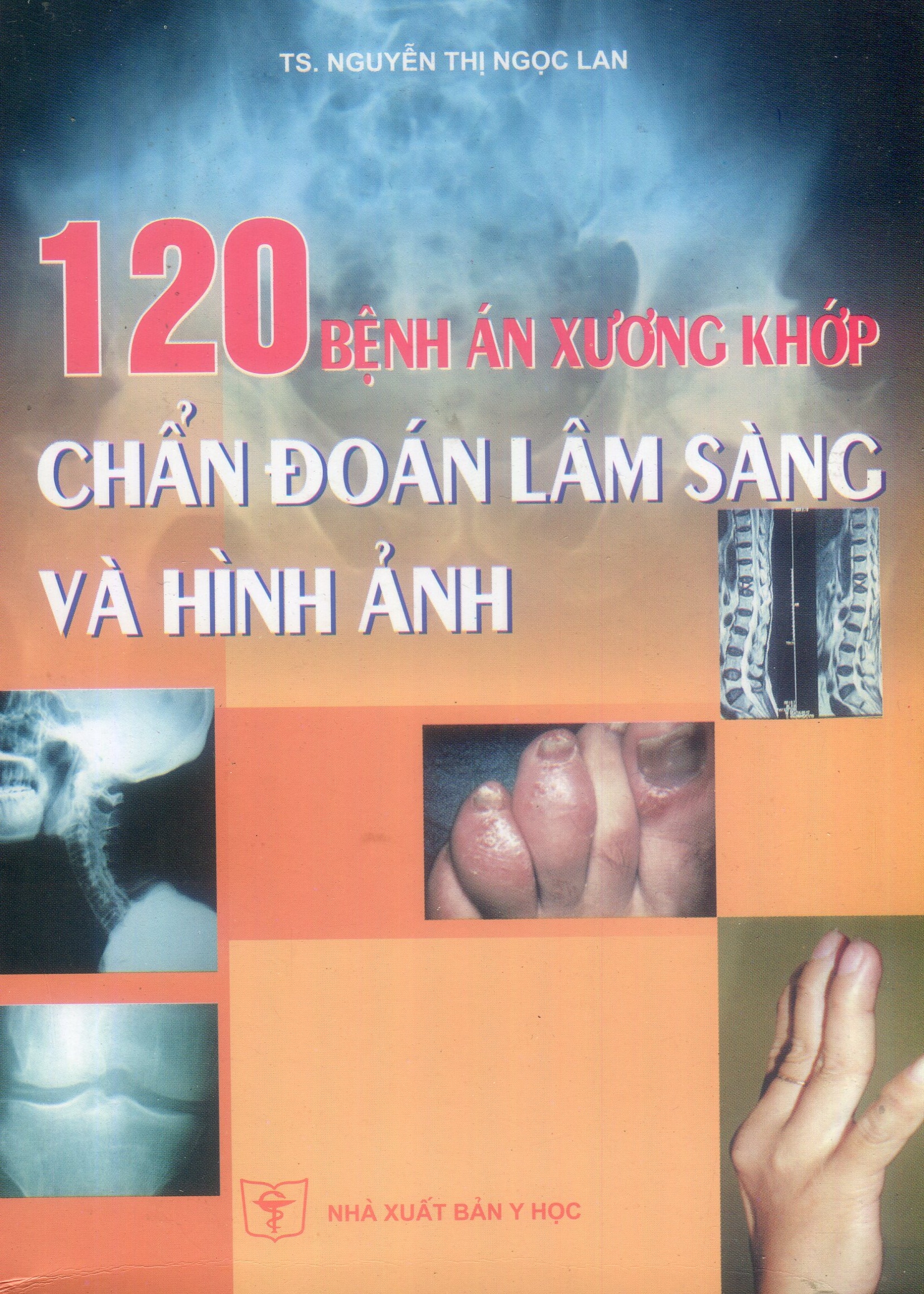 120 bệnh án xương khớp, chẩn đoán lâm sàng và hình ảnh