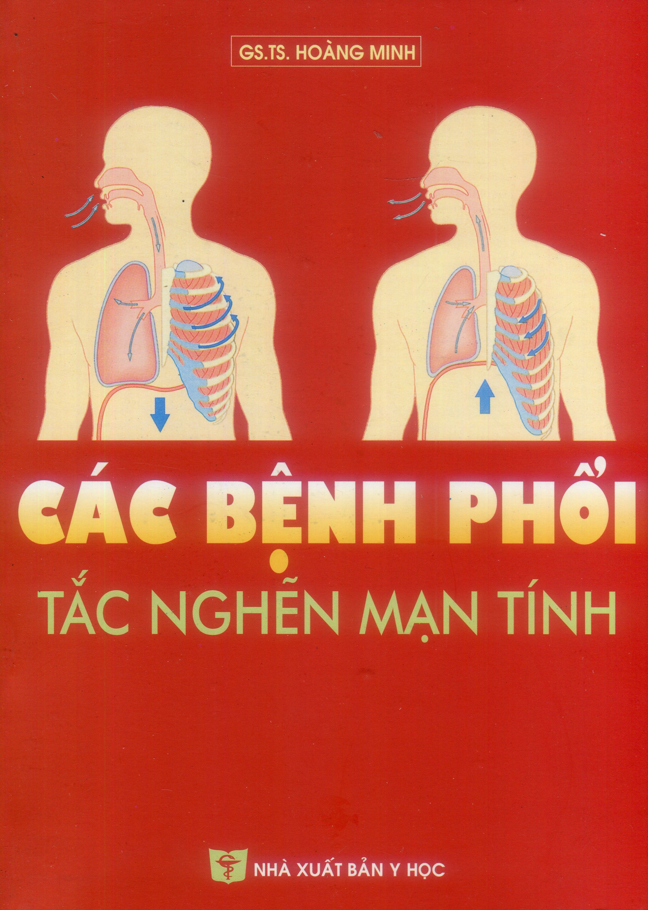 Các bệnh phổi tắc nghẽn mạn tính