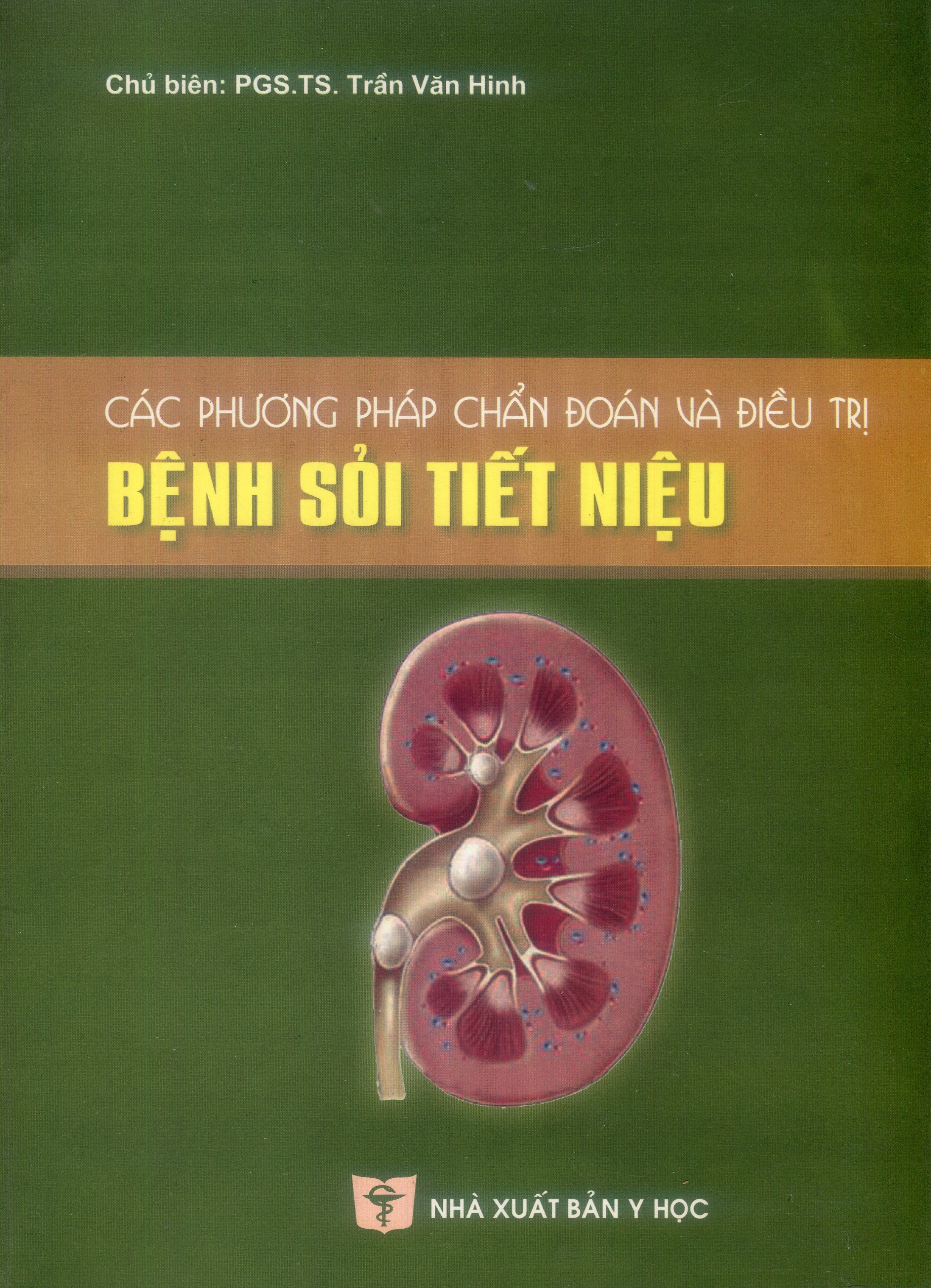 Các phương pháp chuẩn đoán và điều trị bệnh sỏi tiết niệu