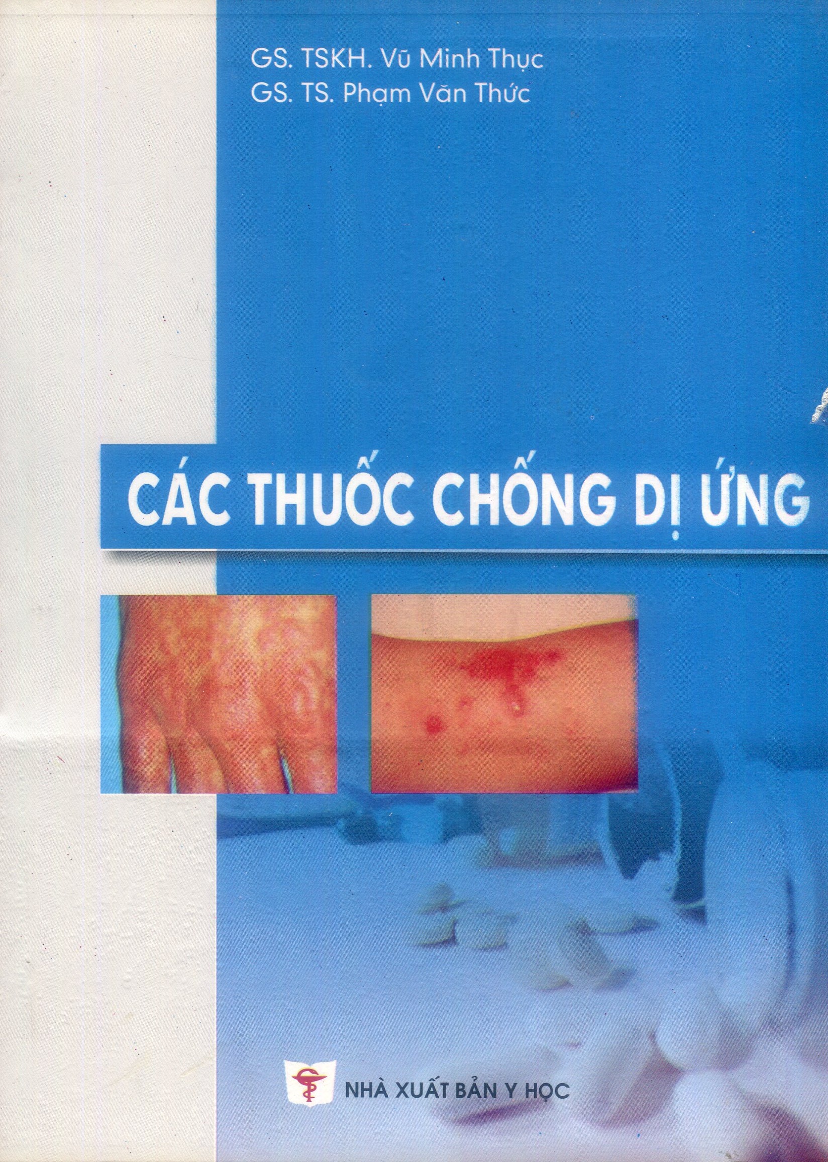 Các thuốc chống dị ứng