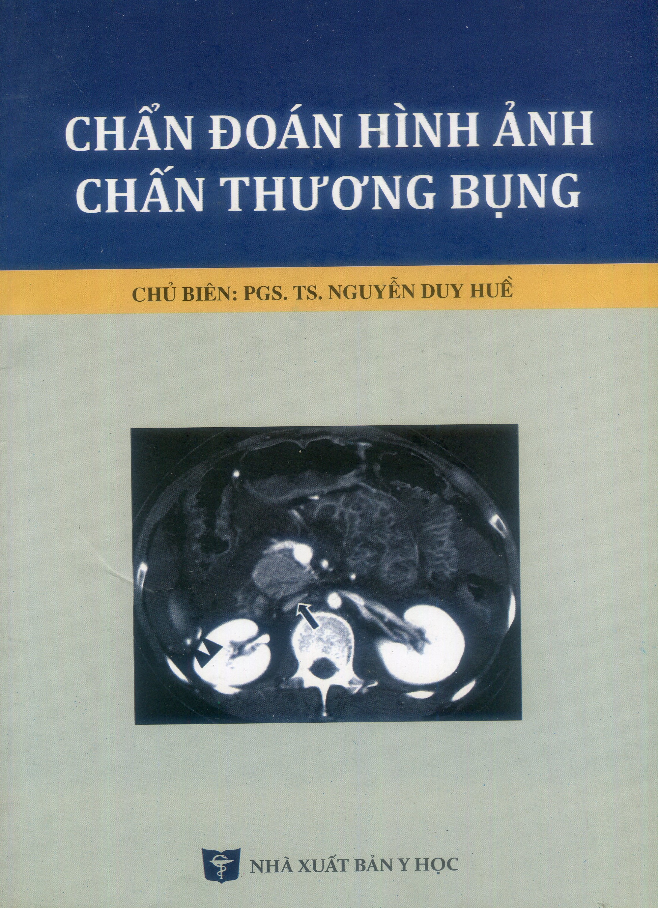 Chẩn đoán hình ảnh chấn thương bụng