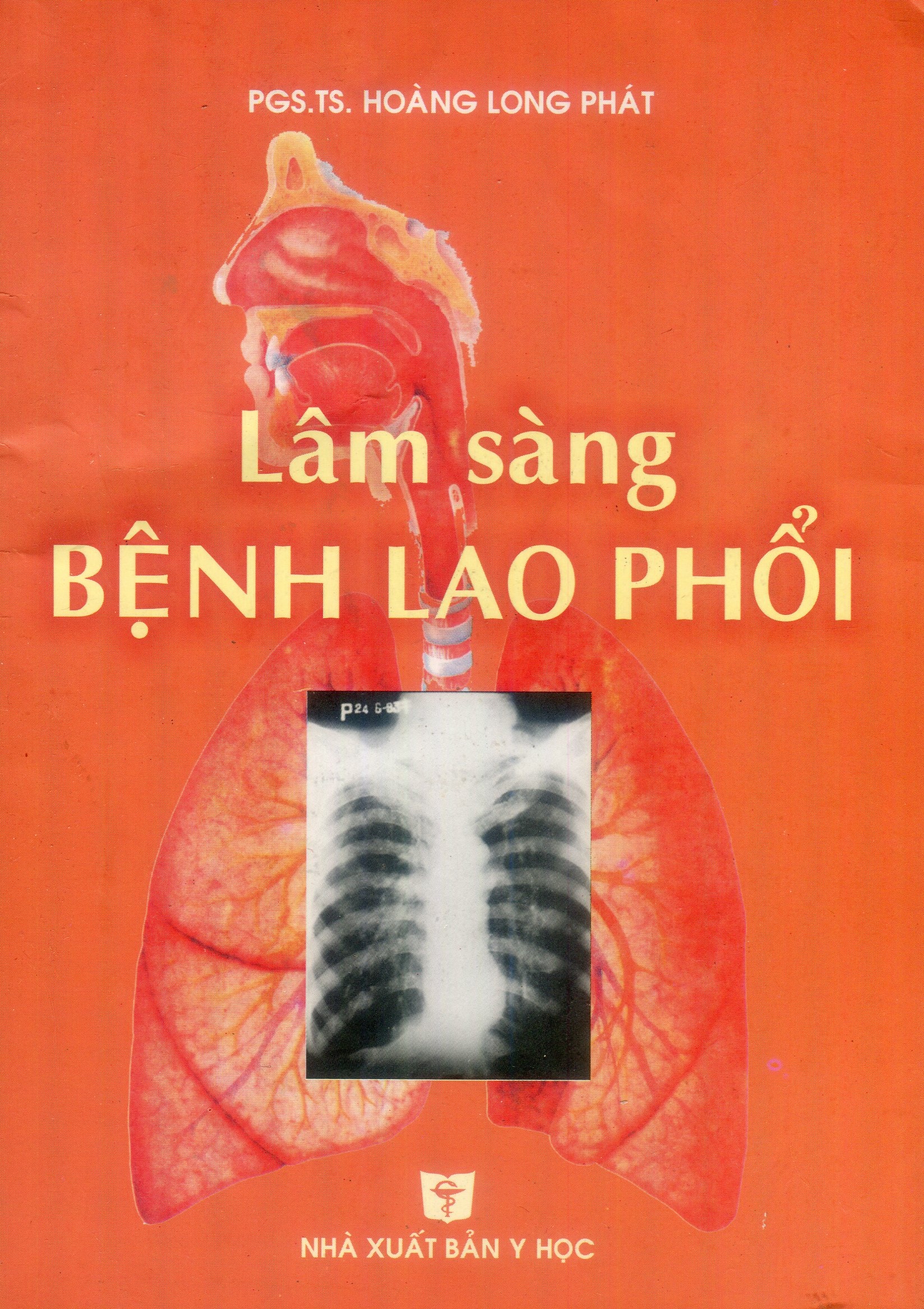 Lâm sàng bệnh lao phổi