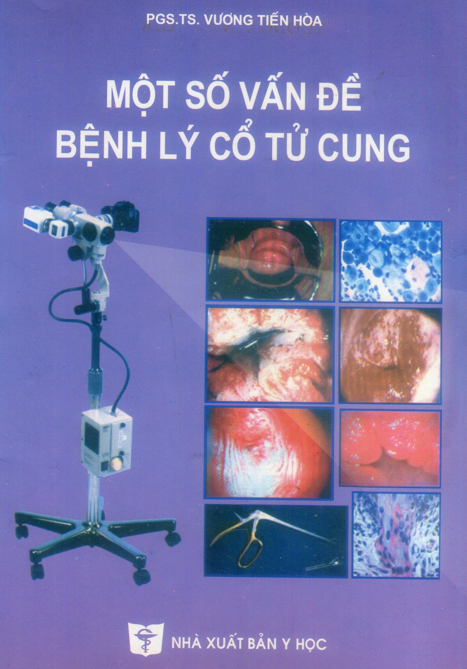 Một số vấn đề bệnh lý cổ tử cung