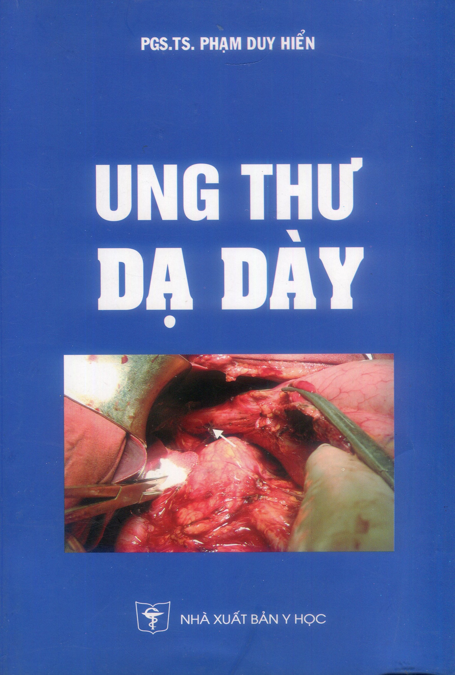Ung thư dạ dày