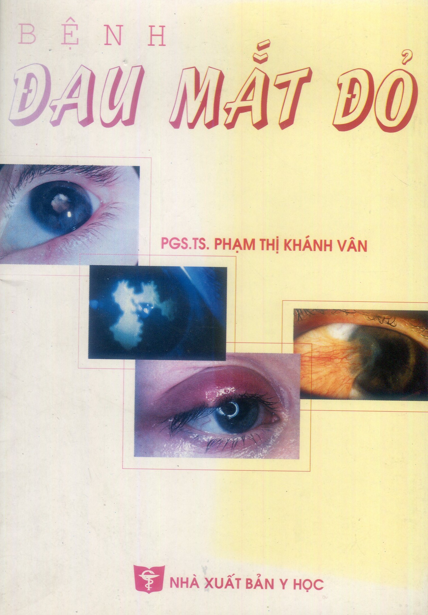 Bệnh đau mắt đỏ