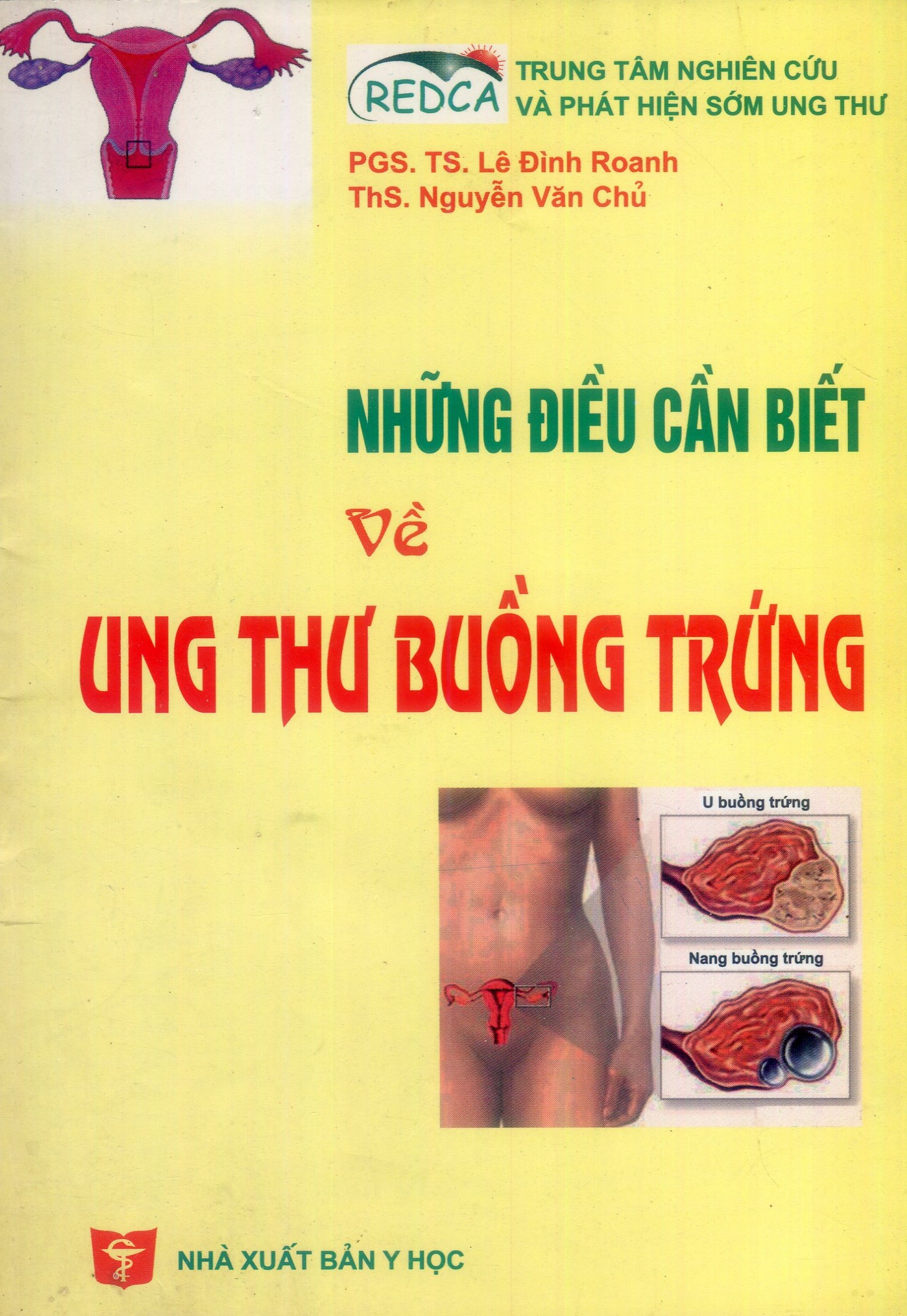 Những điều cần biết về ung thư buồng trứng