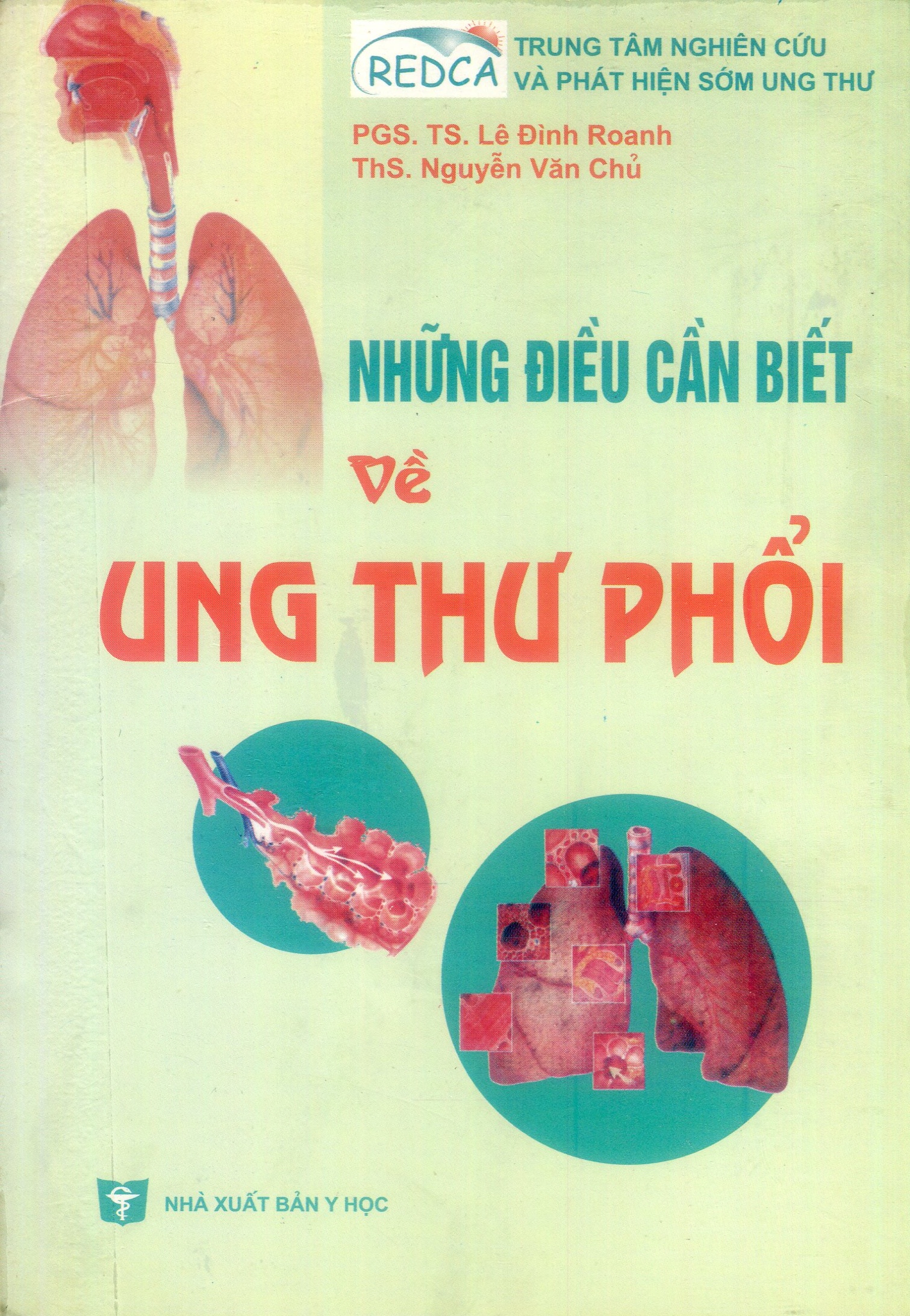 Những điều cần biết về ung thư phổi