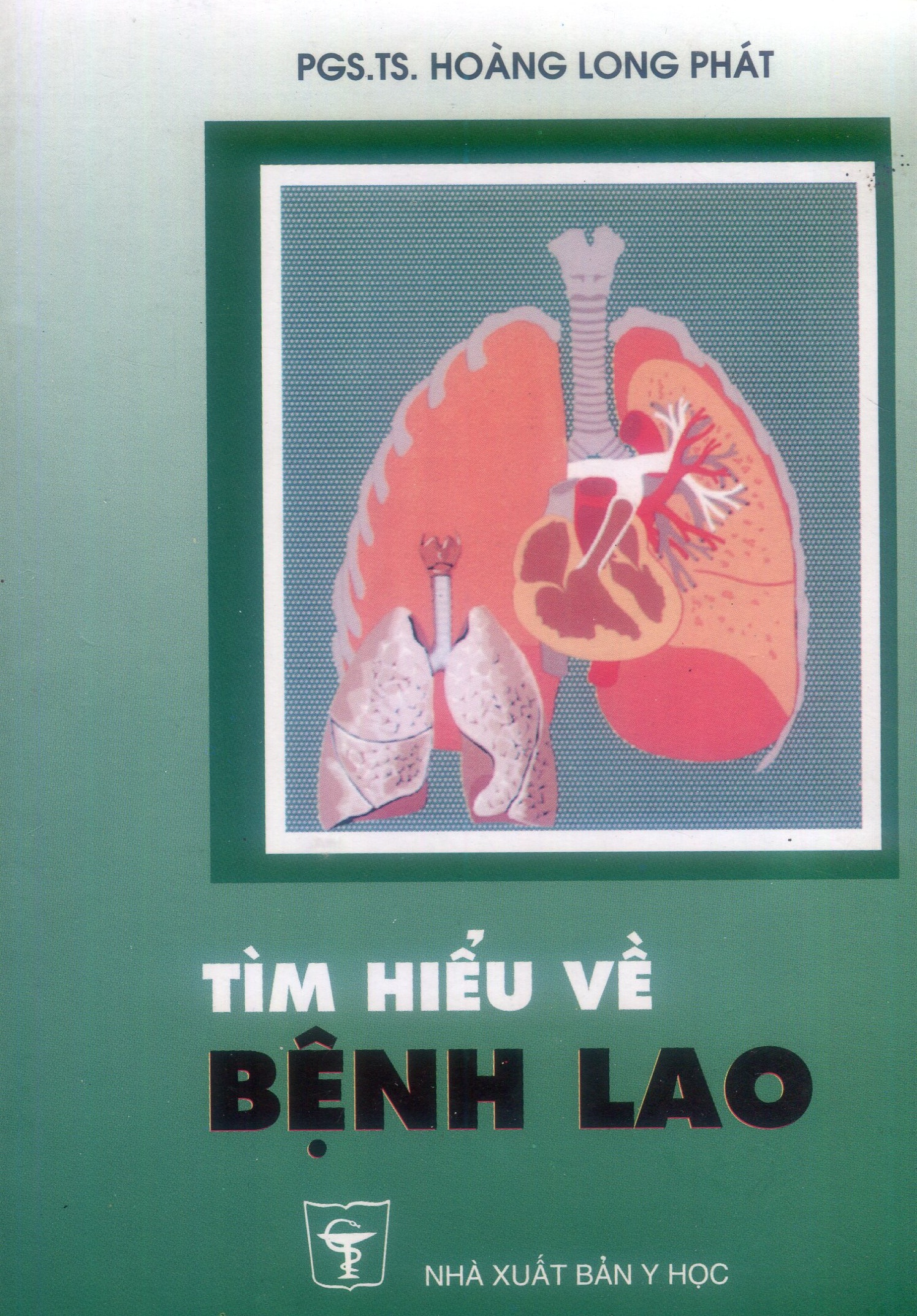 Tìm hiểu về bệnh lao