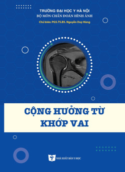 Cộng hưởng từ khớp vai