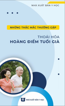 Đái tháo đường và thị lực Tìm hiểu về phù hoàng điểm do đái tháo đường