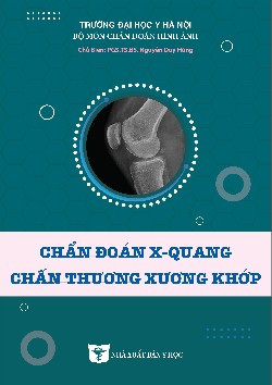 Chẩn đoán X-quang chấn thương xương khớp