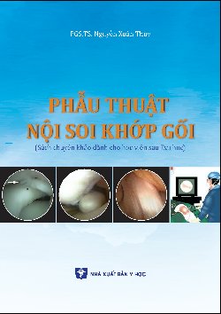 Phẫu thuật nội soi khớp gối (Sách chuyên khảo dành cho học viên sau đại học)
