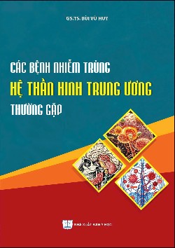 Các bệnh nhiễm trùng hệ thần kinh trung ương thường gặp
