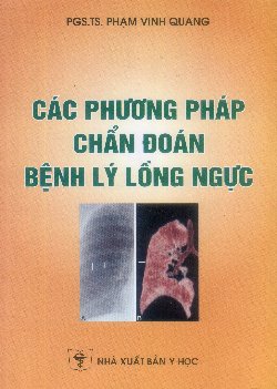 Các phương pháp chẩn đoán bệnh lý lồng ngực