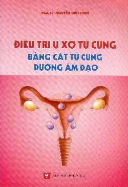 Điều trị u xơ tử cung bằng cắt tử cung đường âm đạo